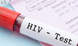 Türkiye’de HIV alarmı