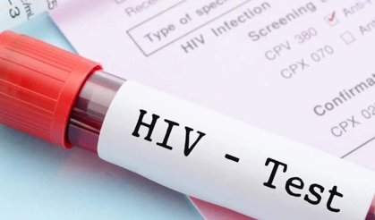 Türkiye’de HIV alarmı