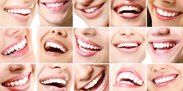 Dişlerinizi Ne Sıklıkla Beyazlatmalısınız?